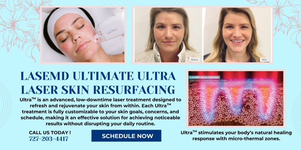 LaseMD Ultimate Ultra Laser Skin Resurfacing